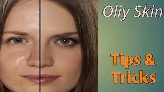 Oil-Free & Fabulous: Essential Ingredients for Oily Skin Care