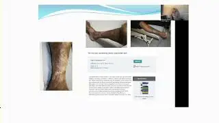 Red Leg Syndrome for clinicians by Rebecca Elwell