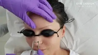 Laser tattoo removal | Permanent eyebrows | Eye Design New York