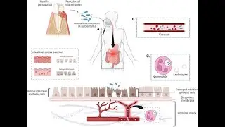 Microorganism Infecting By indirect spread via the blood stream   hematogenous dissemination