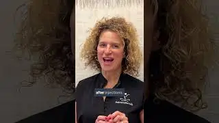 Your Questions About Filler Migration, Answered by Dr. T