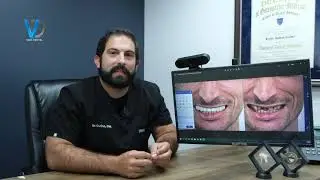 Smile Design Miami by Dr. Cutino at Vida Dental Coral Gables: Smiles Design with Digital Precision