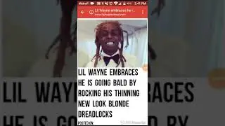 Lil Wayne Is Going Bald And Embraces It !