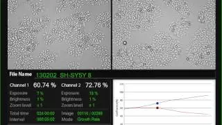 Gachon uni. Gold nanorods treatment on SH-SY5Y (24 hrs) JuLI Br Dual system