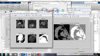 MLP neural network based Efficient Medical Image Segmentation