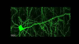 Mouse Cortical Neurons