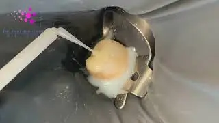 Stamp Technique