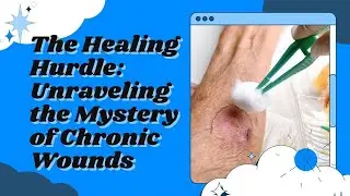 Why Wounds Become Chronic: The Science Behind Slow Healing