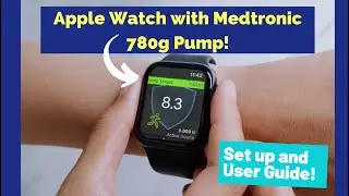 Apple Watch с помпой Medtronic 780 г!