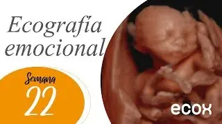 Ecograf&iacute;a Semana 22 de embarazo | Conoce a tu beb&eacute; antes de nacer - Ecox