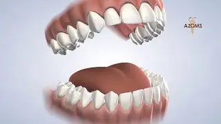 Pre-Operative Instructions in Tucson AZ | Arizona Oral & Maxillofacial Surgeons