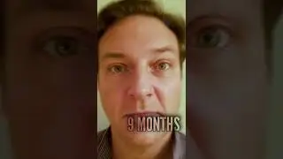 Step back for the countdown! - HAIR TRANSPLANT 9 MONTHS RESULT