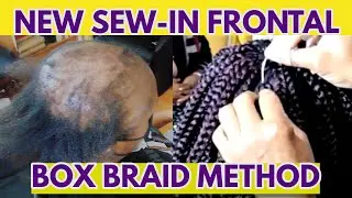 NEW BOX BRAID SEW-IN METHOD WITH FRONTAL BRAIDS FOR ALOPECIA, SHORT, THIN, DAMAGED, HAIR