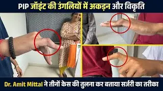 तीन मरीज़, एक जैसी उंगली की समस्या – Dr. Amit Mittal ने कैसे किया अलग-अलग इलाज? | Finger Stiffness