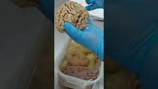 Cerebro 2