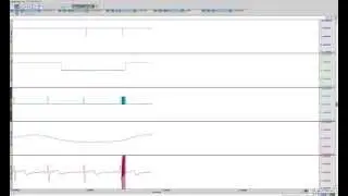 Dual-Channel MRI Gating Systems | DTU200/300 Data
