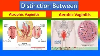 Differences between Atrophic Vaginitis and Aerobic Vaginitis