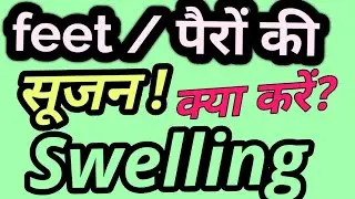पैर की सूजन का कारण और इलाज / Swelling of Feet it's Cause and Treatment /Homeopathic Medicine