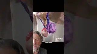entorse testiculaire