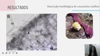 Sycon e Leucandra do Atl&acirc;ntico: diversidade, distribui&ccedil;&atilde;o e caracteriza&ccedil;&atilde;o  de L. rudifera