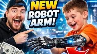 MrBeast&rsquo;s Incredible Kindness 💙 | Fully Functional Robotic Arm Gifted to Armless Boy 🤖✨