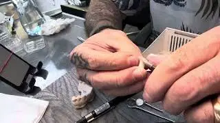Cutback facetas 4