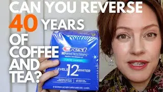 Crest&nbsp;Whitening&nbsp;Strips&nbsp;Review | Before and After (Sensitivity? Effective?)