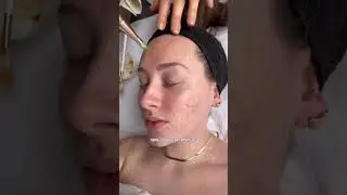 Getting a Nano Infusion Facial