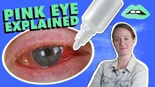 What Is Pink Eye And How Do You Treat It?