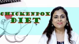 ChickenPox - Doctor Explains | Chickenpox - Food to Eat & Food to Avoid | Mera Doctor