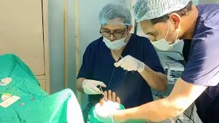 Mutilated Hand #Plastic Surgery | Patient Satisfaction| #Emergency Surgery 
