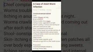 Adult worm Infection cured case by Homeopathic medicines.#homeopathy #medical#worms#medicine#doctor