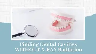 CariVu - Finding dental cavities WITHOUT X-ray radiation