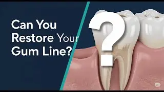 How to Stop Receding Gums: 5 Natural Steps to Help Restore Your Gum Line