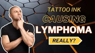 Do Tattoos Cause Lymphoma ,Cancer :The Swedish Study