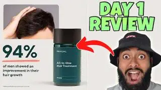 I Started The MANUAL Hair Treatment Plan With Finasteride & Minoxidil!