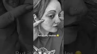 Embrace Your Freckles This Summer #filter #freckles