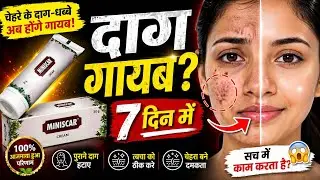 दाग़ धब्बे हटाने की क्रीम| Miniscar Cream for Scar Removal| Charak Pharma|