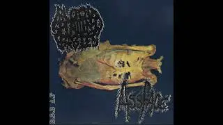 ASSFACE- BSB SPLIT (ASSFACE SIDE)(MINCEGORE)(2024)
