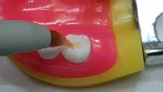 Ionomero Modificado con Resina - ucsur