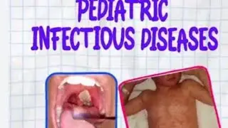 Pediatric chicken pox and typhoid 