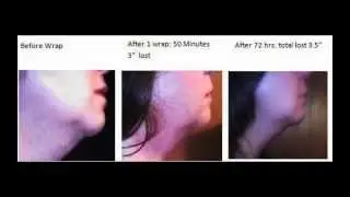 Skin Tightening Body Wraps Review