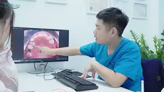 Tư Vấn Niềng Răng Cho Người Mất Nhiều Răng | Nha Khoa Minh Châu