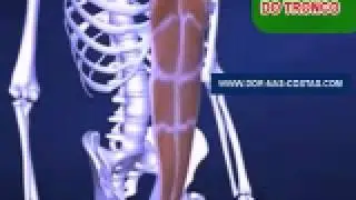 Hernia de Disco, Extrusão, Protusão, Abaulamento, Nervo Ciático. Dr. Gilberto explica o que são.