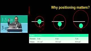 BRONCHOSCOPIC ABLATION FOR LUNG NODULES -  Dr Kevin Lau