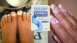 Vi Spieghiamo Perché Il Bicarbonato Di Sodio è Uno Dei Rimedi Più Potenti