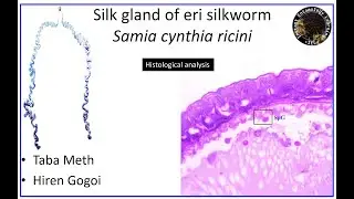 Structure of the Silk Gland of Eri Silkworm (Samia cynthia ricini)