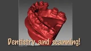 3D scan of dentistry objects in FlexScan3D automatically._FlexScan3D стоматология 3D сканирование