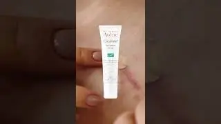 different creams for different marks on skin#skin #tips #skincareoem #skinprotection #skinformation