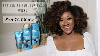 How to Remove Buildup FAST | Testing Royal Oils by Head & Shoulders on My Dry Scalp